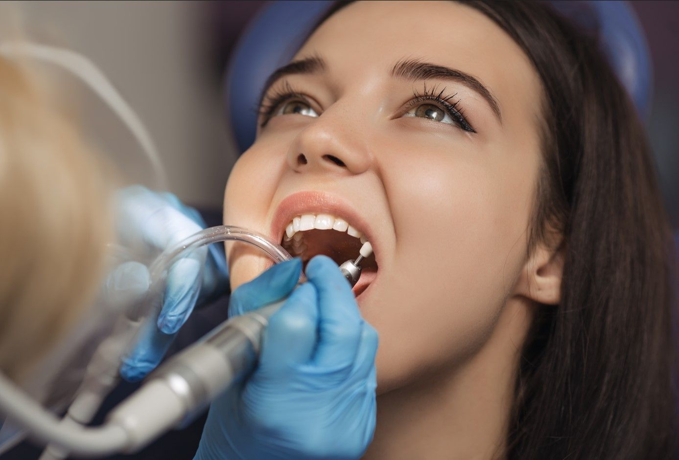 Глубокий кариес: как избежать осложнений и сохранить зуб?