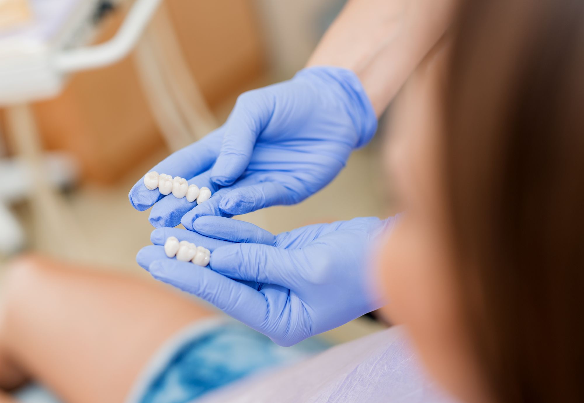 Методы фиксации съемного зубного протеза 4