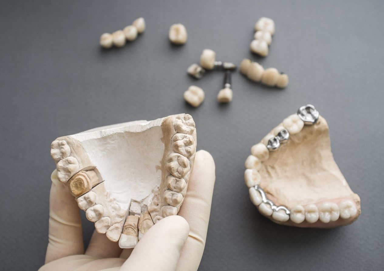 С какими зубными протезами удобно жевать?