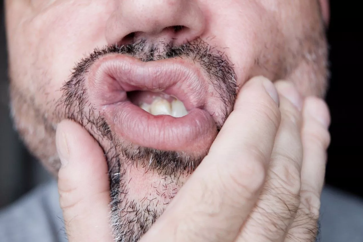 Оголение шейки зуба: причины, лечение и симптомы