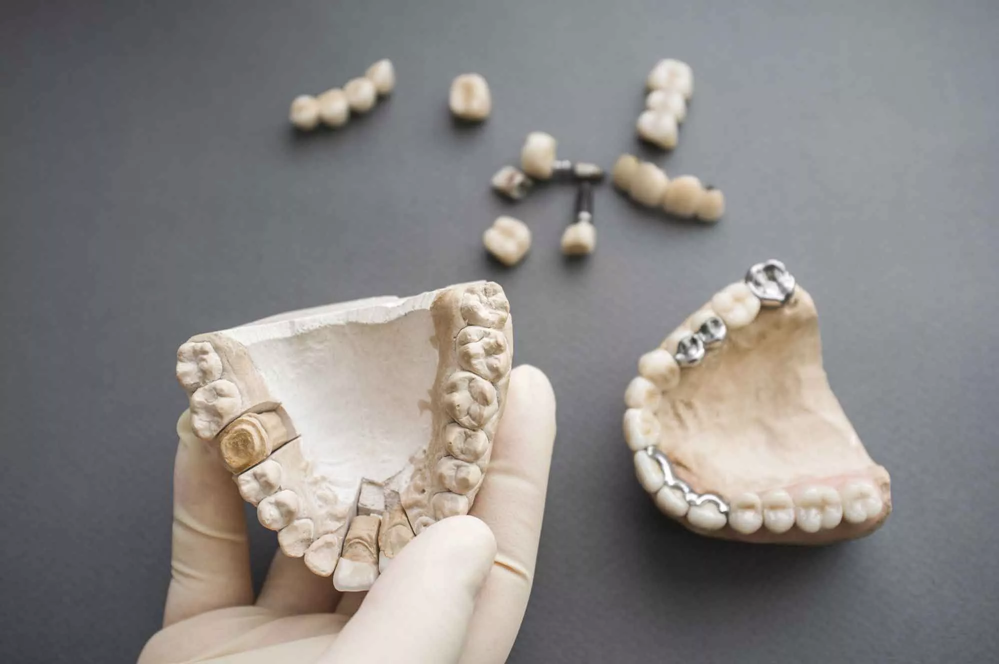 Больно ли делать имплантацию зубов? 4