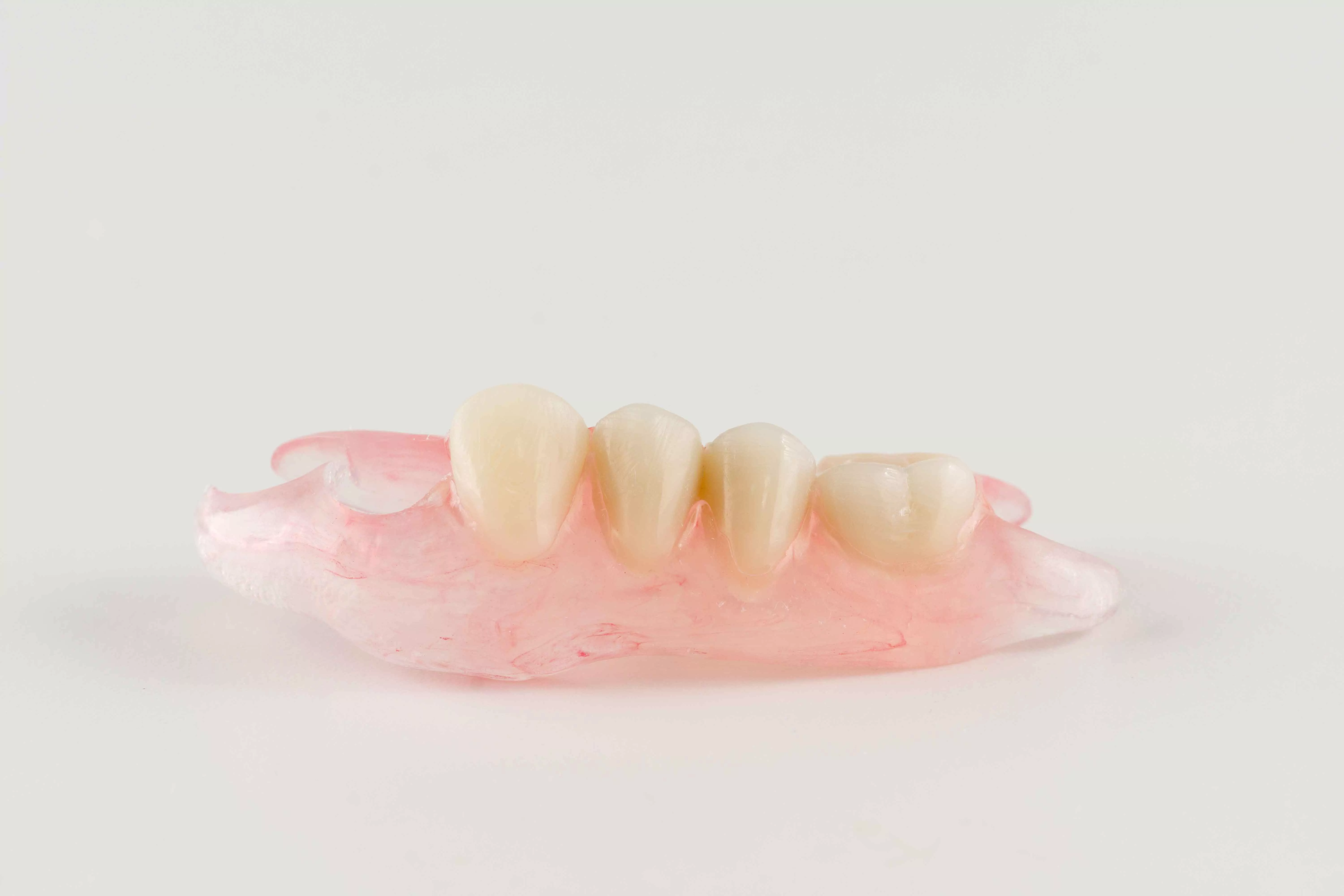 Нейлоновые зубные протезы 2