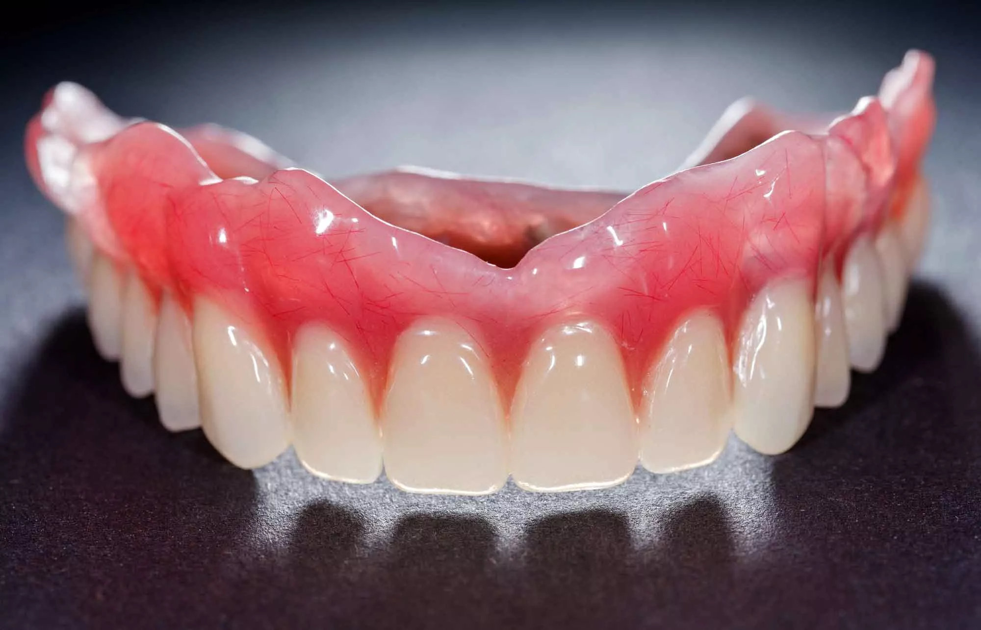 Методы фиксации съемного зубного протеза 0
